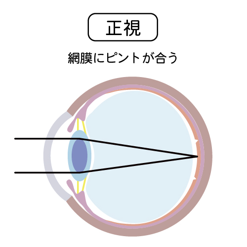 正視
