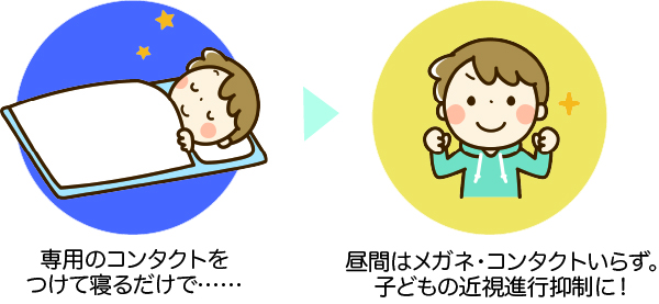 オルソケラトロジーとは