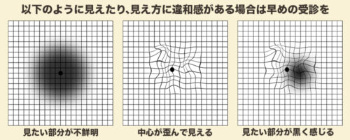 アムスラーチャード