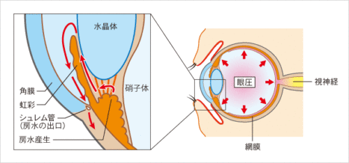緑内障とは