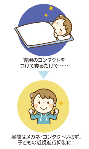 オルソケラトロジーのイメージ