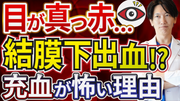 白目が赤い!危険なの!?結膜下出血の原因と対処法を眼科医が詳しく解説 | コラム – 経堂こうづき眼科