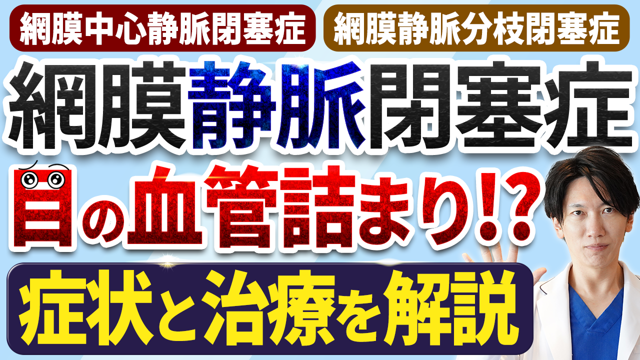 RVO解説