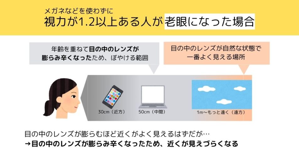 視力が1.2以上ある人が老眼になった場合