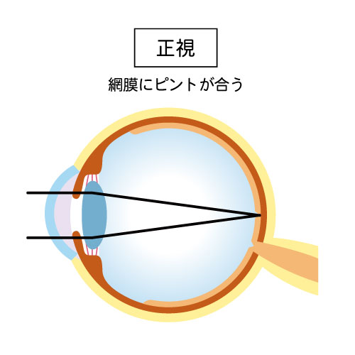 正視
