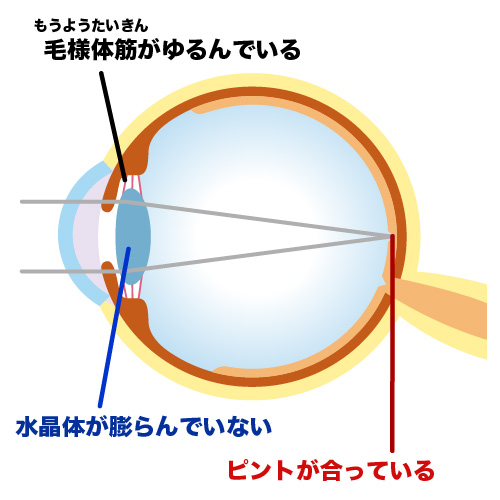 毛様体筋が緩んでいる状態