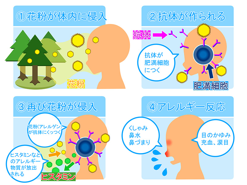 アレルギーの仕組み