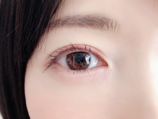経結膜脱脂術