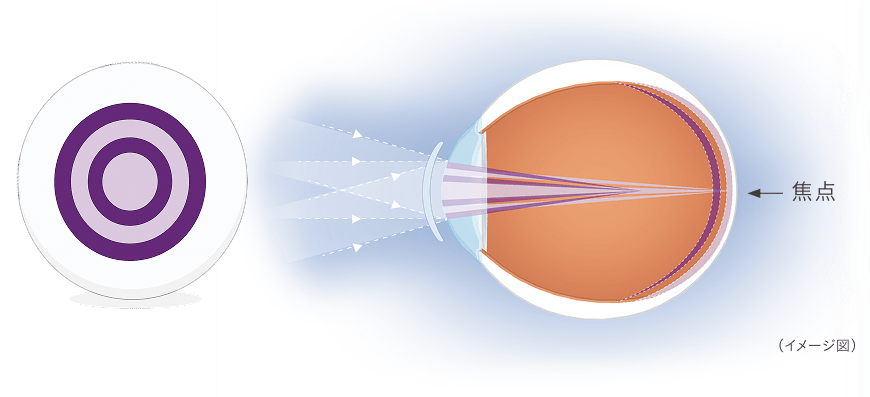 デュアルフォーカスデザイン