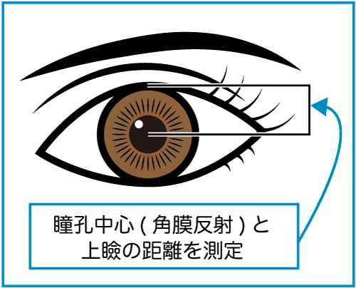 採血